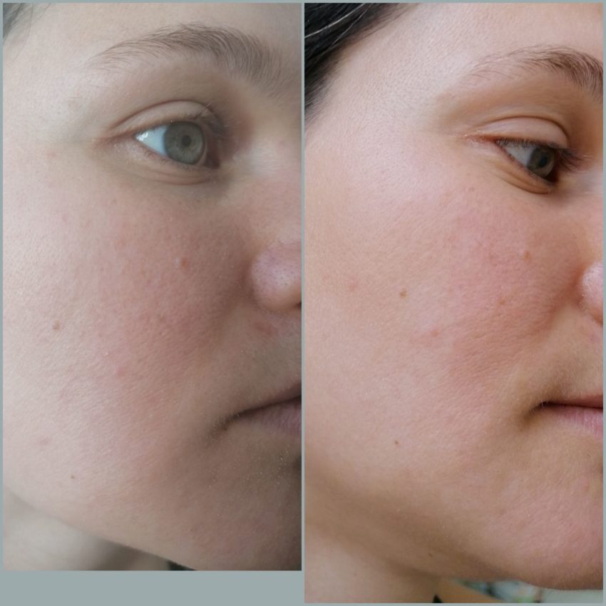 Фото 4